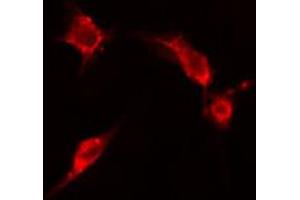 ABIN6266602 staining HepG2 cells by IF/ICC. (ENO2/NSE 抗体  (C-Term))
