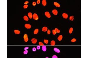 Immunofluorescence analysis of U-2 OS cells using Symmetric DiMethyl-Histone H3-R2 Polyclonal Antibody at dilution of 1:100 (40x lens). (Histone 3 抗体  (H3R2me2s))