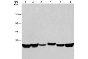 Western Blot analysis of LoVo and A375 cell, Mouse brain tissue, HepG2, A431 and Hela cell using HNRNPH1 Polyclonal Antibody at dilution of 1:350