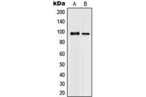 Western blot analysis of PML expression in K562 (A), COLO320 (B) whole cell lysates. (PML 抗体  (N-Term))