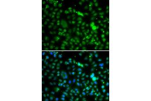 Immunofluorescence analysis of MCF7 cell using NSUN6 antibody. (NSUN6 抗体)