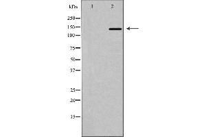 Western blot analysis of MDR1 using HT-29 whole cell lysates,The lane on the left is treated with the antigen-specific peptide. (ABCB1 抗体  (Internal Region))