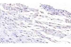 Detection of DSG3 in Human Placenta Tissue using Monoclonal Antibody to Desmoglein 3 (DSG3) (Desmoglein 3 抗体  (AA 334-604))