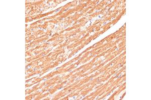 Immunohistochemistry of paraffin-embedded mouse heart using CYB5A antibody (ABIN6130832, ABIN6139296, ABIN6139297 and ABIN6221049) at dilution of 1:100 (40x lens). (CYB5A 抗体  (AA 1-100))