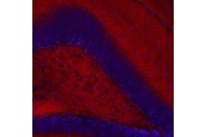 Indirect immunostaining of a PFA fixed mouse hippocampus section (dilution 1 : 200, red). (CASKIN1 抗体)