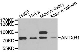 Western blot analysis of extracts of various cell lines, using ANTXR1 antibody. (ANTXR1 抗体)