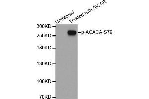 Western blot analysis of extracts from 293 cells using Phospho-ACACA-S79 antibody. (Acetyl-CoA Carboxylase alpha 抗体  (pSer79))