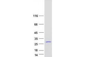 Western Blotting (WB) image for Eukaryotic Translation Initiation Factor 3 Subunit K (EIF3K) protein (Myc-DYKDDDDK Tag) (ABIN2720083)