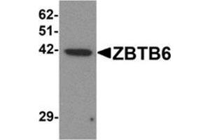 Western blot analysis of ZBTB6 in EL4 cell lysate with ZBTB6 antibody at 1 μg/ml. (ZBTB6 抗体  (Center))