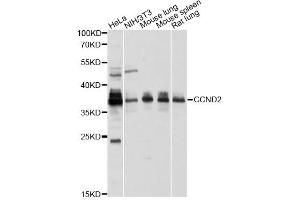 Western blot analysis of extracts of various cell lines, using CCND2 antibody (ABIN1875413) at 1:1000 dilution. (Cyclin D2 抗体)