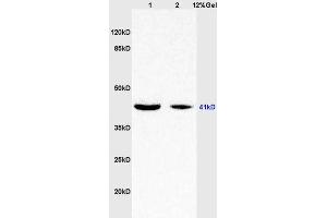 Lane 1: rat brain lysates Lane 2: human colon carcinoma lysates probed with Anti WNT7A Polyclonal Antibody, Unconjugated (ABIN719336) at 1:200 in 4 °C. (WNT7A 抗体  (AA 241-349))
