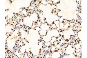 Hemoglobin subunit beta Antibody at 1/100 staining Mouse lung tissue by IHC-P.