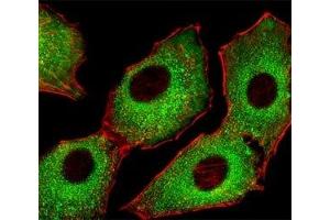 Immunofluorescence (IF) image for anti-Cyclin-Dependent Kinase 5 (CDK5) (AA 254-289) antibody (ABIN3030614)