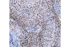 IHC analysis of SP1 using anti-SP1 antibody (ABIN7601559). (SP1 抗体  (AA 384-603))