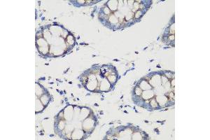 Immunohistochemistry of paraffin-embedded human colon using GLUD1 antibody at dilution of 1:200 (40x lens). (GLUD1 抗体)