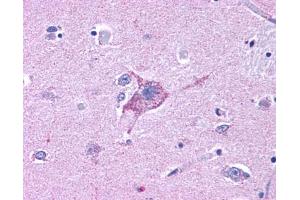 Anti-NPY5R antibody IHC of human brain, neurons and glia. (NPY5R 抗体  (Cytoplasmic Domain))