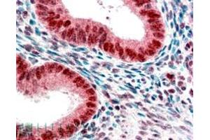 Immunohistochemistry (IHC) image for anti-Chromobox Homolog 5 (CBX5) (Internal Region) antibody (ABIN185491)