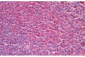 anti-Tumor Protein, Translationally-Controlled 1 (TPT1) antibody