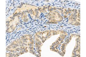 ABIN6265370 and ABIN6272981 at 1/100 staining Rat ovary tissue by IHC-P. (SULT1E1 抗体  (Internal Region))