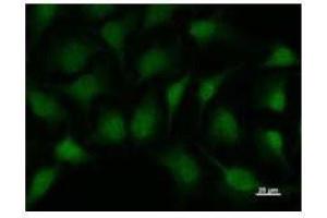 Immunostaining analysis in HeLa cells. (SMAD1 抗体)
