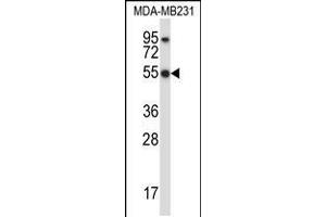 Western blot analysis in MDA-MB231 cell line lysates (35ug/lane). (HCLS1 抗体  (C-Term))