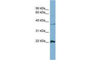 Image no. 1 for anti-RAN, Member RAS Oncogene Family (RAN) (AA 143-192) antibody (ABIN6741892) (RAN 抗体  (AA 143-192))