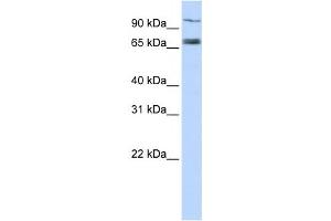 Western Blotting (WB) image for anti-Transporter 1, ATP-Binding Cassette, Sub-Family B (MDR/TAP) (TAP1) antibody (ABIN2458765) (TAP1 抗体)