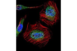 Fluorescent confocal image of Hela cell stained with MLLT10 (AF10) Antibody (Center) (ABIN1882102 and ABIN2850420). (MLLT10 抗体  (AA 294-323))