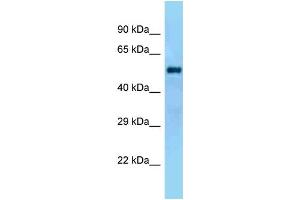WB Suggested Anti-Gal3st4 Antibody Titration: 1. (GAL3ST4 抗体  (N-Term))