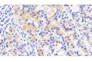 Immunohistochemistry (IHC) image for anti-Agmatine Ureohydrolase (Agmatinase) (AGMAT) (AA 53-151) antibody (ABIN7436726)