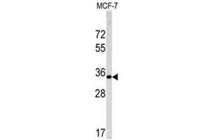 Image no. 1 for anti-Emerin (EMD) (C-Term) antibody (ABIN452956) (Emerin 抗体  (C-Term))