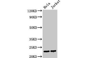 Western Blot Positive WB detected in: Hela whole cell lysate, Jurkat whole cell lysate All lanes: PTTG1 antibody at 3 μg/mL Secondary Goat polyclonal to rabbit IgG at 1/50000 dilution Predicted band size: 23 kDa Observed band size: 23 kDa (PTTG1 抗体  (AA 2-202))