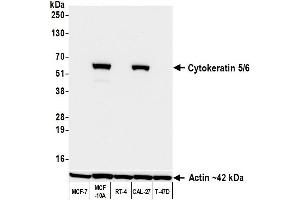 Western Blotting (WB) image for anti-Keratin 5/6 (KRT5/6) (C-Term) antibody (ABIN7795769) (Recombinant Keratin 5/6 抗体  (C-Term))