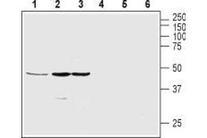 Western blot analysis of rat pancreas (lanes 1 and 4), SH-SY5Y (lanes 2 and 5) and MS1 (lanes 3 and 6) lysates: - 1-3. (GHSR 抗体  (2nd Extracellular Loop))