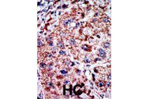 Immunohistochemistry (IHC) image for anti-Phosphofructokinase, Liver (PFKL) antibody (ABIN3003704) (PFKL 抗体)