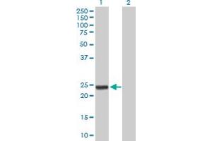 Western Blot analysis of ARHGDIA expression in transfected 293T cell line by ARHGDIA MaxPab polyclonal antibody. (ARHGDIA 抗体  (AA 1-204))