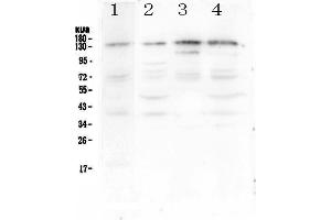 Western blot analysis of EPS15 using anti-EPS15 antibody . (EPS15 抗体  (AA 2-88))