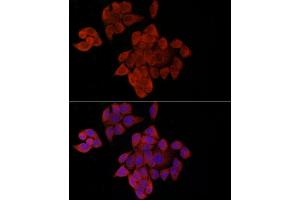 Immunofluorescence analysis of HeLa cells using OP antibody (ABIN6129426, ABIN6145031, ABIN6145032 and ABIN6225150) at dilution of 1:100 (40x lens). (OPA1 抗体  (AA 661-960))