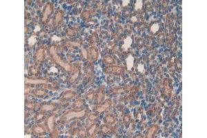 Immunohistochemistry (IHC) image for anti-Microfibrillar Associated Protein 5 (MFAP5) (AA 32-164) antibody (ABIN1859805)