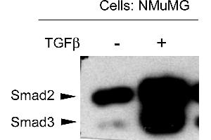 NMuMG mouse mammary epithelial cells were probed for the activation of Smad3 by detecting phosphorylation of threonine 179. (SMAD3 抗体  (Internal Region, pThr179))