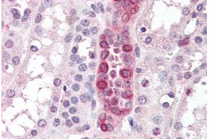 Human Kidney (formalin-fixed, paraffin-embedded) stained with PTGS1 antibody ABIN461923 at 3. (PTGS1 抗体  (AA 617-630))