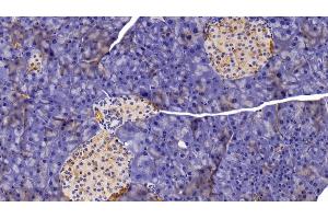 Detection of CHIT1 in Mouse Pancreas Tissue using Polyclonal Antibody to Chitinase 1 (CHIT1) (Chitotriosidase 1 抗体  (AA 210-464))
