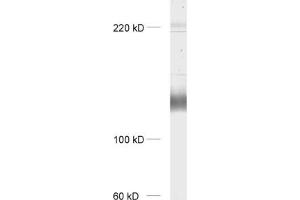 dilution: 1 : 1000, sample: rat brain homogenate (mGluR1 alpha 抗体  (AA 1092-1199))
