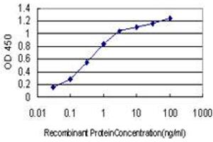 Detection limit for recombinant GST tagged CYP46A1 is approximately 0. (CYP46A1 抗体  (AA 201-300))