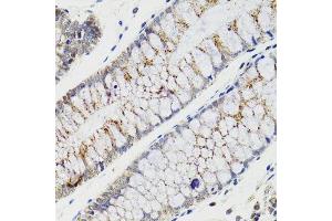 Immunohistochemistry of paraffin-embedded human rectum using CHMP4B antibody.
