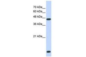 Image no. 1 for anti-Histone Deacetylase 8 (HDAC8) (N-Term) antibody (ABIN6742492) (HDAC8 抗体  (N-Term))