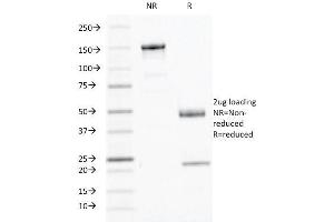 SDS-PAGE Analysis Purified Interferon gamma Mouse Monoclonal Antibody (IFNG/466). (Interferon gamma 抗体)