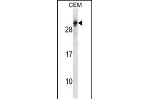 Western blot analysis in CEM cell line lysates (35ug/lane). (RGS5 抗体  (N-Term))