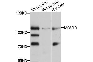 Western blot analysis of extracts of various cell lines, using MOV10 antibody (ABIN1873740) at 1:1000 dilution. (MOV10 抗体)