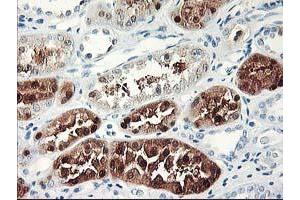 Image no. 1 for anti-Uracil-DNA Glycosylase (UNG) antibody (ABIN1501681) (UNG 抗体)